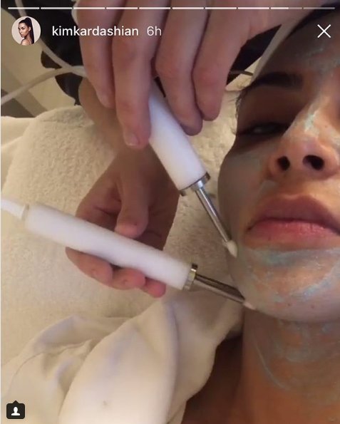 sisiestetik's tweet photo. Ameliyatsız yüz germe.. #CACIOSCARBEAUTY https://t.co/KAeJD4s8UO  
#lifting #facelifting #women #yüzkaldırma #rejerenasyon #beauty #güzellik #estetik #kadın #ciltbakımı #yenilenme https://t.co/9aHk8nzZ2g