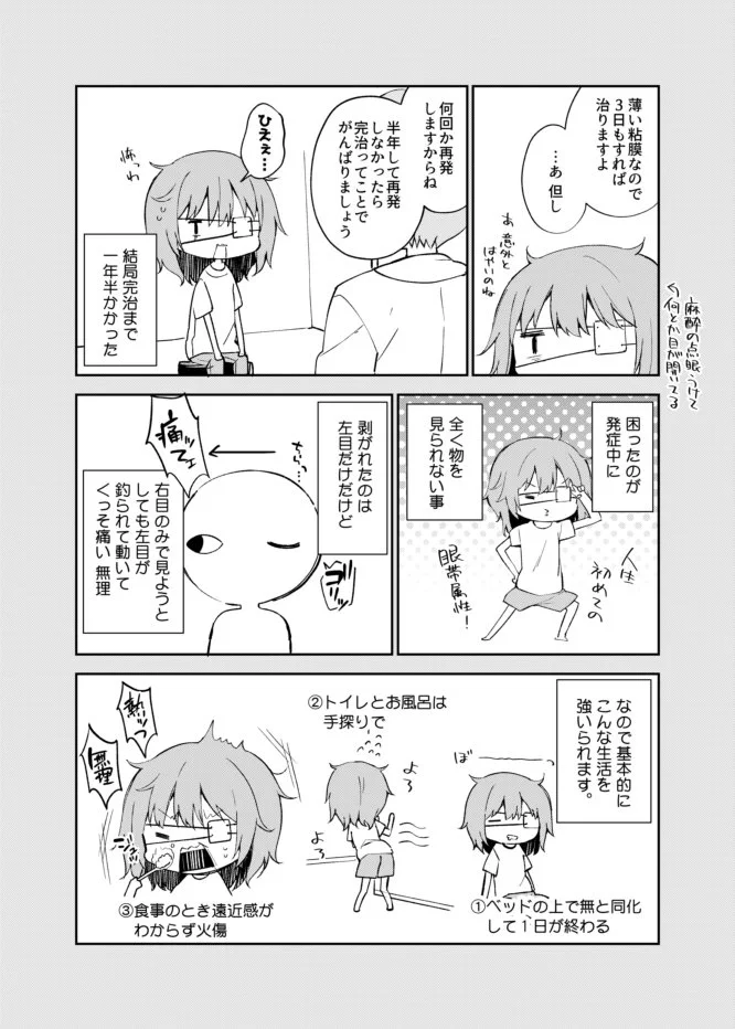 実はコンタクトじゃなくても網膜剥離になる？！ドライアイの人は気をつけて！