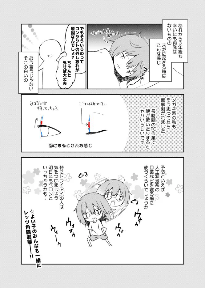実はコンタクトじゃなくても網膜剥離になる？！ドライアイの人は気をつけて！