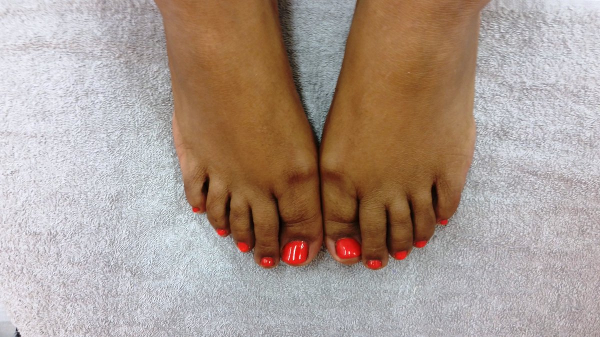 BiosphericSouth's tweet photo. Electric orange on toes :) https://t.co/cCwhjzDFpF