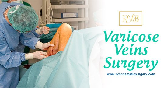 RVB_Cosmetics's tweet photo. If endothermal ablation treatments and sclerotherapy are unsuitable for you, you'll usually be offered a surgical procedure called ligation and stripping to remove the affected veins. #varicoseveins #surgery #legs https://t.co/tX2hkYbYoM