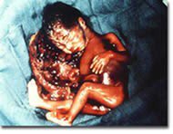 #FamiliesBelongTogether means nothing,why should I or any American care about these people when unborn American babies are expendable? I submit to you that America has taught it’s people through actions which are much stronger than the words they contradict that no life matters