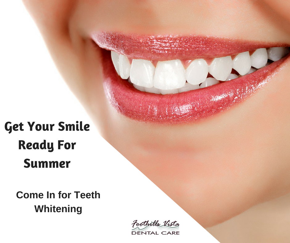 FoothillsVista's tweet photo. Summer is here and it is time to get your smile looking brighter than the summer sun! Call us today to get you the Hollywood smile everyone loves. 

(480) 295 - 7192 https://t.co/HEkBLuQlx2