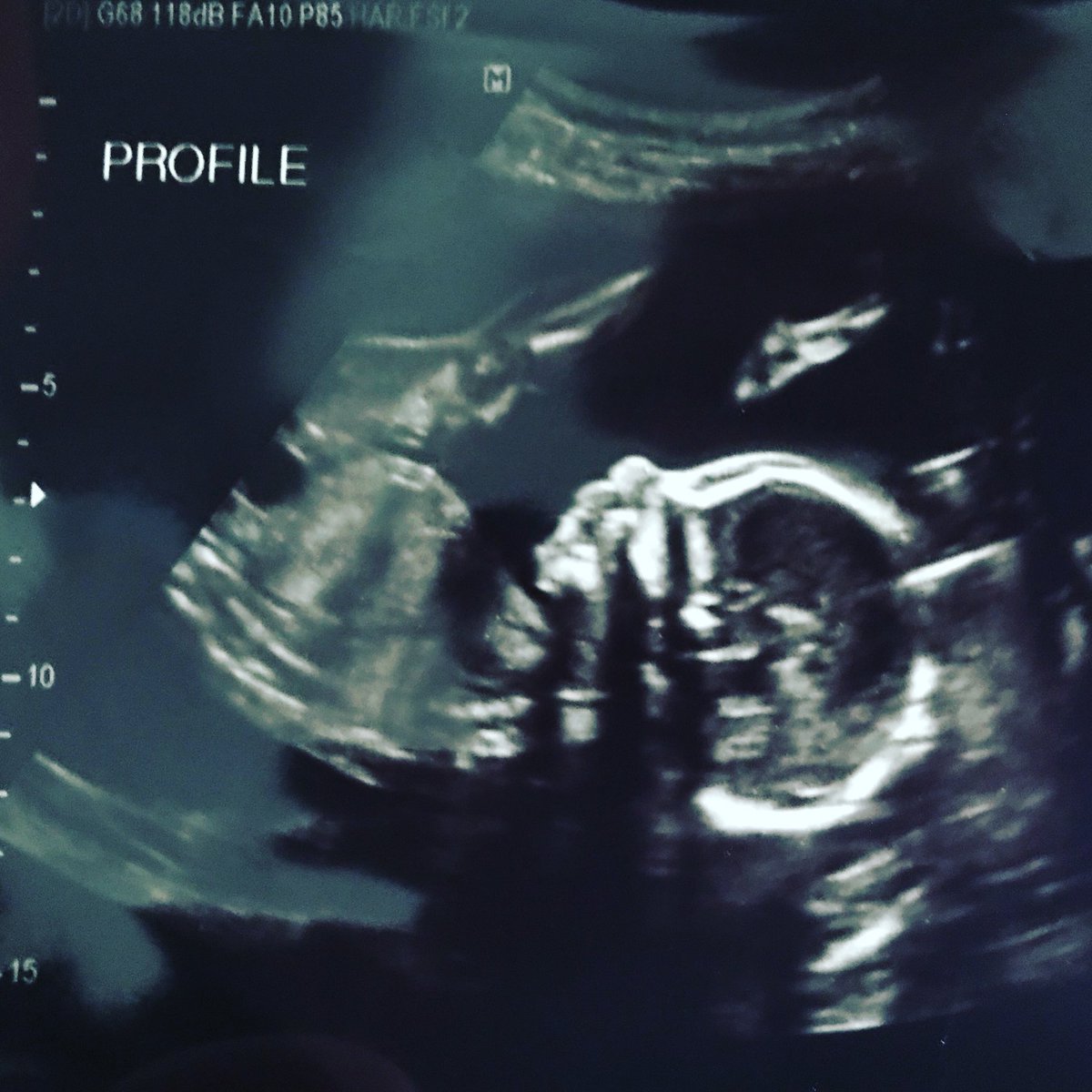 Brian Gerhardstein tweet media