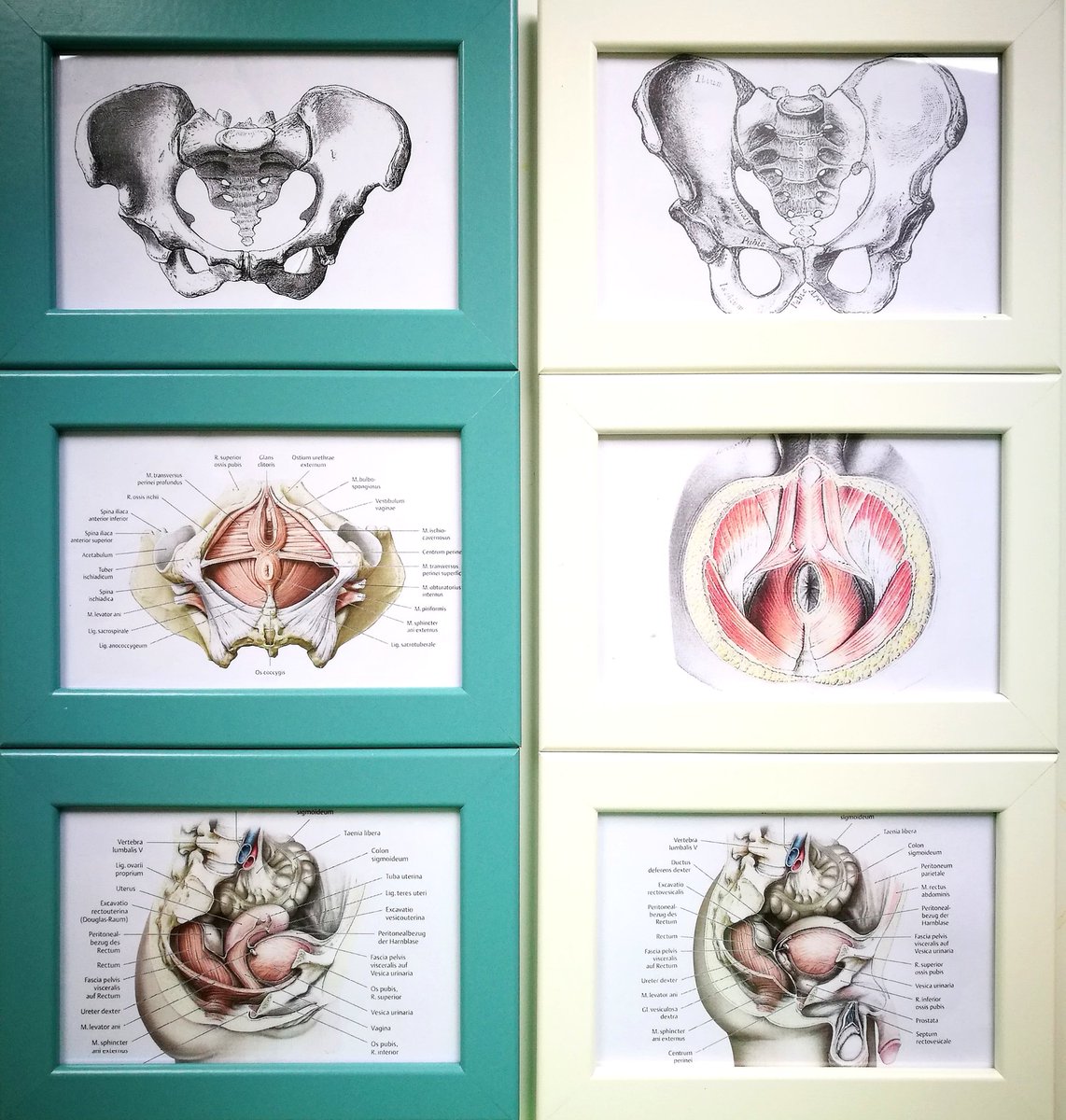 Ich erkläre dir die Anatomie und Funktion damit du verstehst warum du deine Beschwerden hast und was du tun kannst, damit es besser wird!
#beckenbodentherapie
#ohnemeinenphysiotherapeuten
#therapeutenamlimit