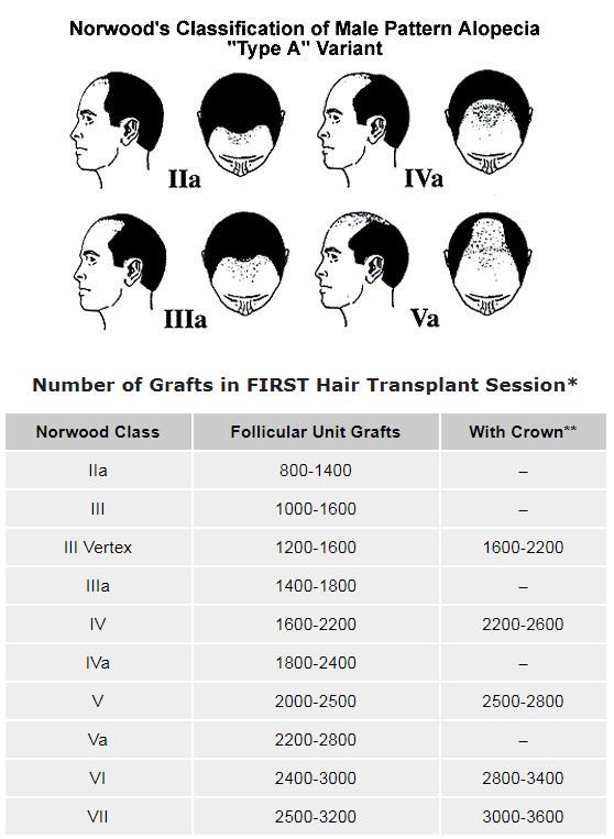 #WednesdayWisdom: this graph helps to determine how many grafts are needed during a first #hairtransplant procedure. bit.ly/2GLl4U8
