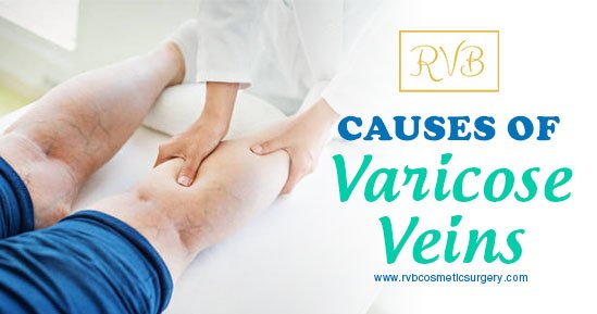 RVB_Cosmetics's tweet photo. If the walls of the vein become stretched and less flexible, the valves may get weaker. A weakened valve can allow blood to leak backward and eventually flow in the opposite direction. When this occurs, blood can accumulate in the veins, which then become enlarged and swollen. https://t.co/uKfSVd5v8i