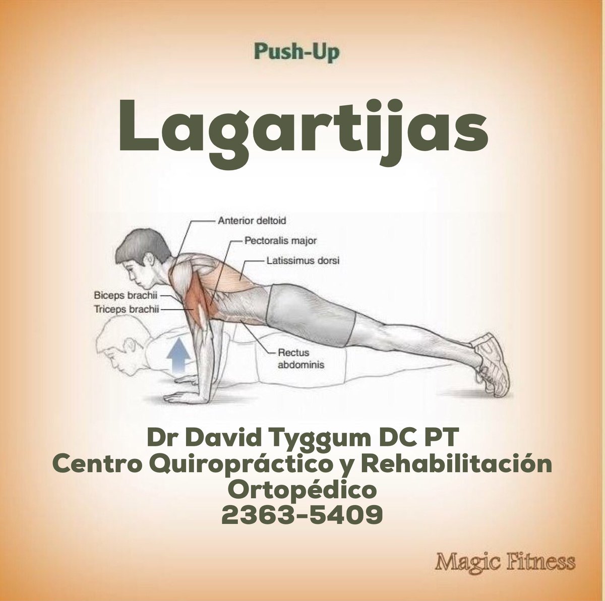 #guatemala #guate #quiropractico
#quiropracticos #quiro #saludguatemala #salud #fisioterapia #masaje #postura #dolor #yoga #ejercicio #movimientoesmedicina #ortopedia #columna #espalda #bienestar 
#QuiropracticosdelFLAQ #quiropraxia
#exercise #pushups #lagartijas