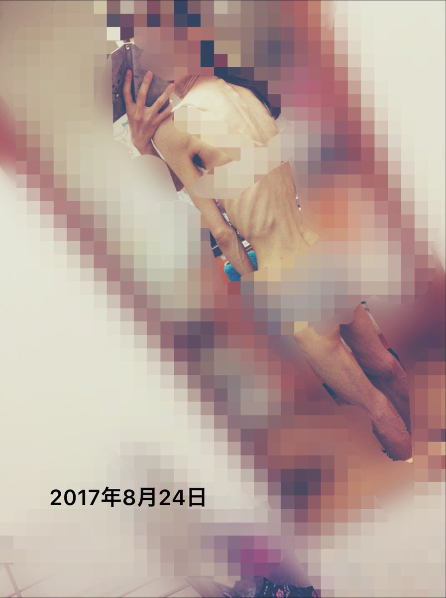 ni5_le's tweet photo. なんと昨日ついに生理きました🙋‍♀️✨
高校生の時にもホルモン治療したり入院して体重増やしても来なかったのに、昔より体重はなくても体力なり食べる物なり気持ちの変化が大きかったのかなあって😌🌱

1枚目が最近
2～4枚目が半年前

最近少しバストアップもしました🤣 https://t.co/WKEhMCEy7O