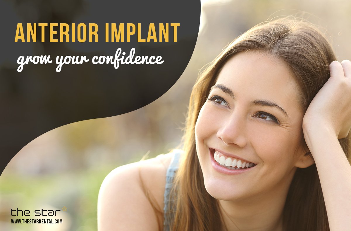 thestarclinickr's tweet photo. https://t.co/ZUljgUbVZQ
#breastimplantplacement
#immediateimplantplacementprotocol
#immediatevsdelayedimplantplacement
#implantplacementsteps
#criteriaforimmediateimplantplacement
#aestheticzonedefinition
#restoringanteriorimplants https://t.co/jj10S8RVvz