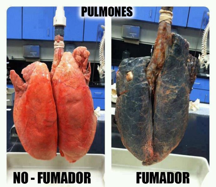 guardiacivil's tweet photo. Tantos años sin fumar, y lo bien que nos sentimos...
¿Cuánto llevas tú?
Hoy 31/05/2018 es el #DíaMundialSinTabaco
¿Te animas a dejarlo? https://t.co/TwJnS8zxld