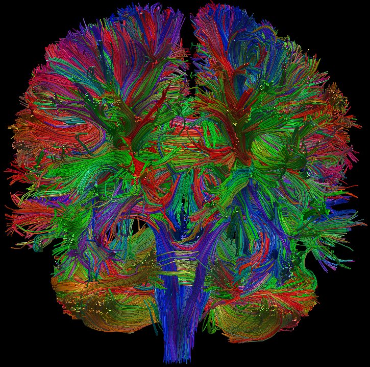 Chris__Guillen's tweet image. #DiffusionTensorImaging is beautiful
Which brings me to another status I wanted to make
In late 2017 I had a #CT scan performed on me (because I’m sick obviously), but as I was reading about #DTI earlier today I started thinking about how I don’t remember the locations and
