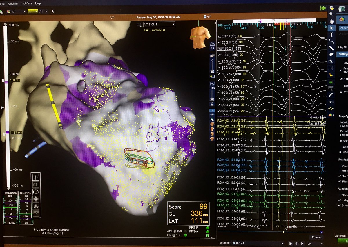 Santosh Padala tweet media