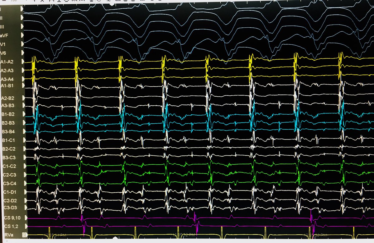 Santosh Padala tweet media
