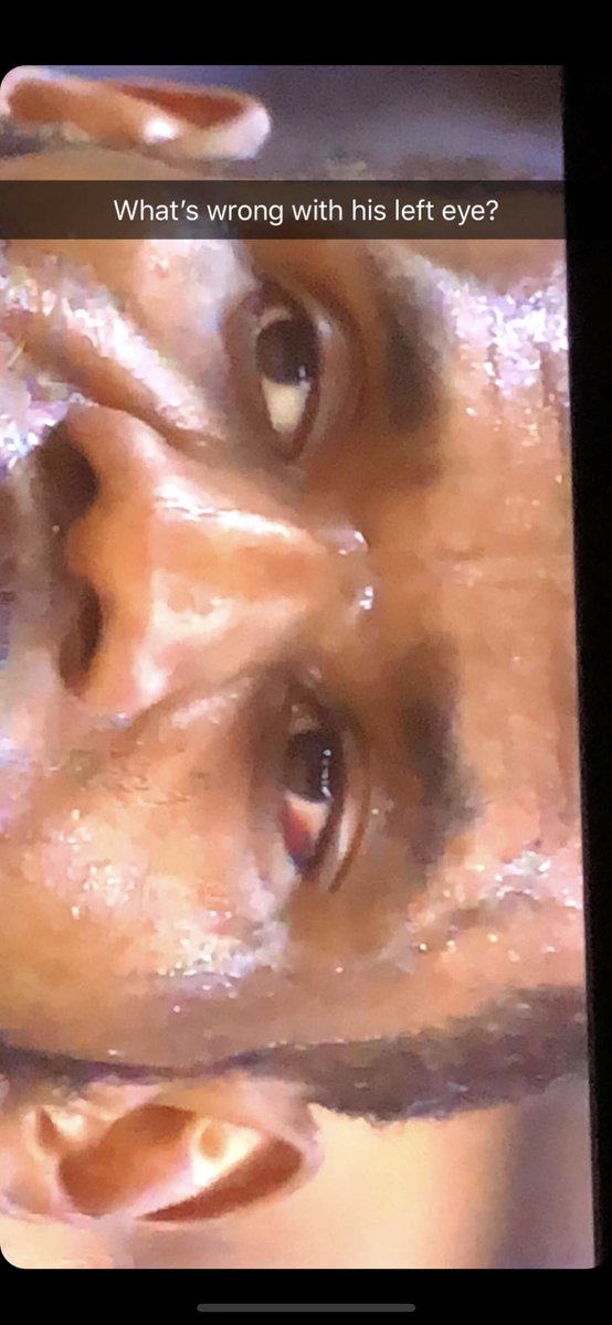 Juliette Eye Institute | Robert F. Melendez, MD tweet media