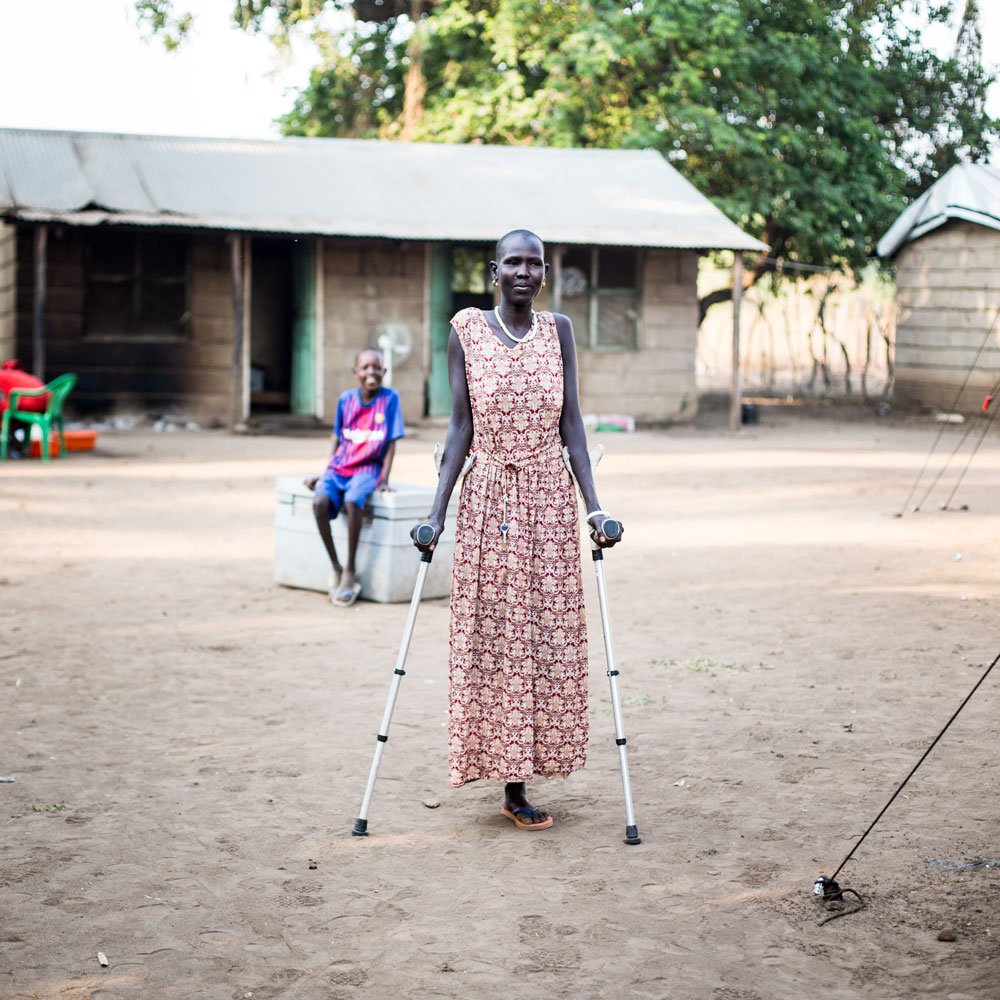 ICRC_Africa's tweet photo. Nyalual was shot when her village in #SouthSudan was attacked. By the time we medevaced her, her leg had become badly infected &amp; had to be amputated. Despite this, she is determined to recover &amp; shares a smile with us. https://t.co/puDXU2s4vz