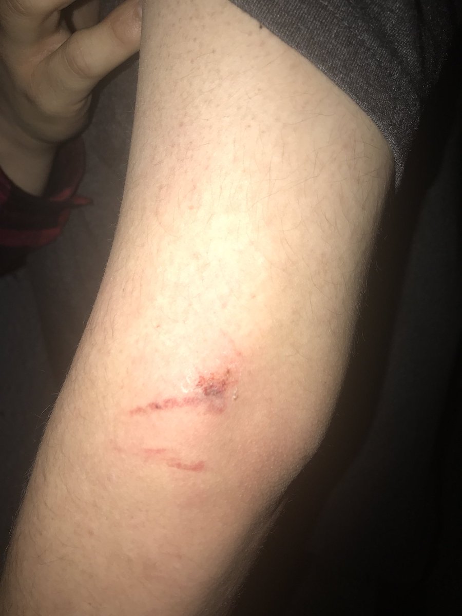 Hey <a href="/lyft/">Lyft</a> got hit by one of your drivers just now... thx for hiring people who run red lights. Ya I have a pic of his license too.