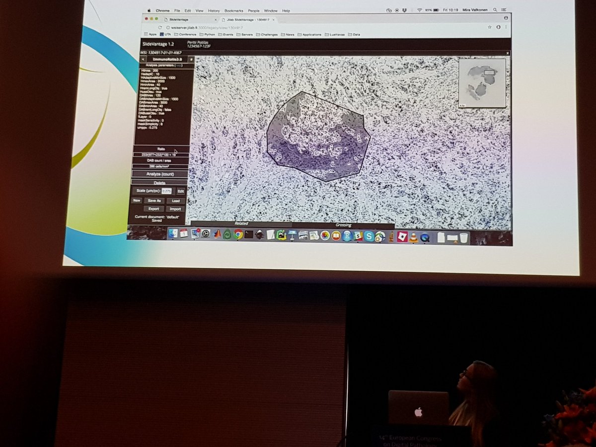 PekkaRuusuvuori's tweet photo. #ECDP2018 Deep learning based detection of tissue demonstrated in a talk by Mira Valkonen from our bioimage informatics group @UniTampere https://t.co/jJlbla5NSa