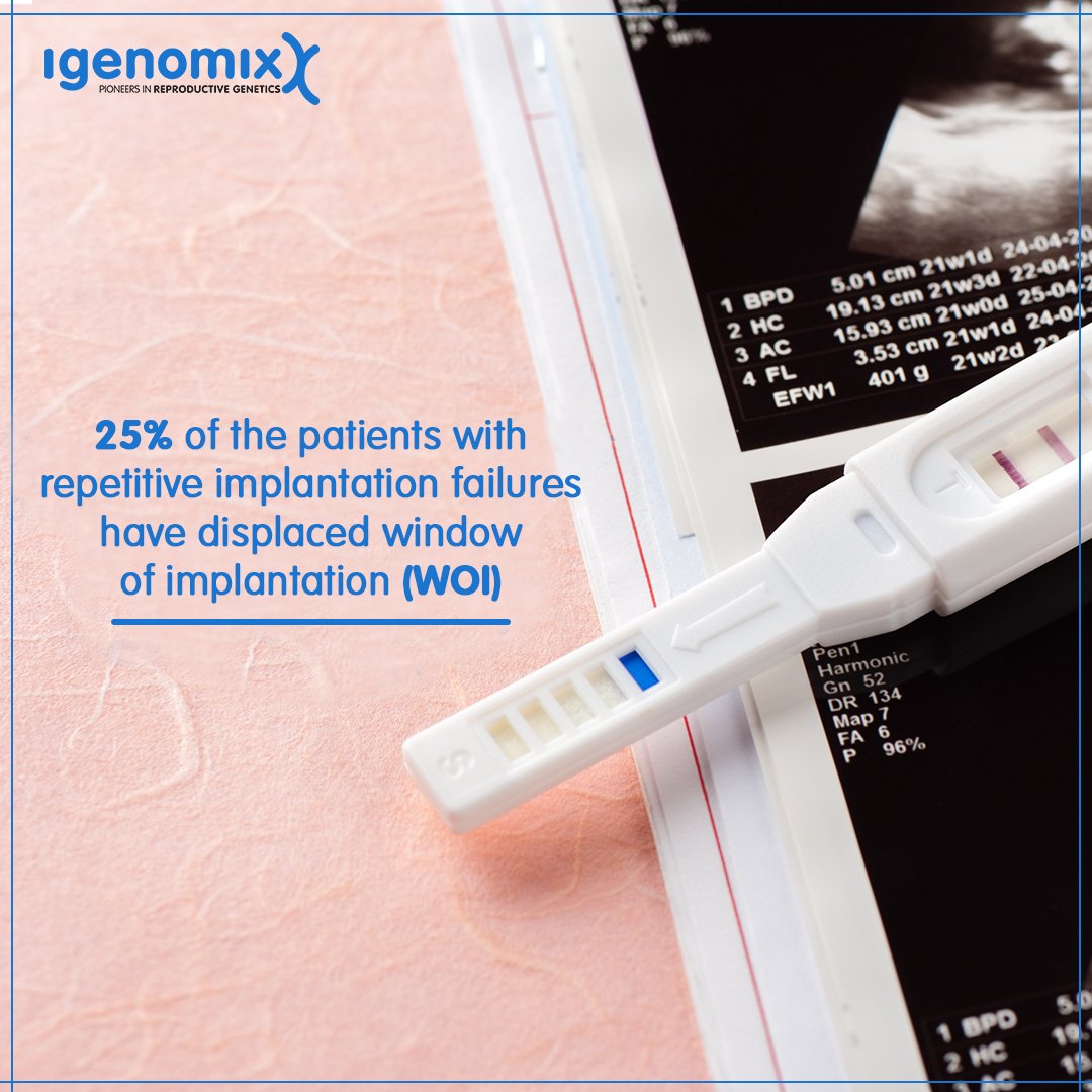 igenomixindia's tweet image. Are your patients tired of repetitive IVF failures? Ensure successful IVF implantation in patients with ERA (Endometrium receptivity Analysis). 
To know more about ERA, Visit goo.gl/fj3uSX 
#IVFSuccess #IVF #ChromosomalAbnormalities #EmbryoQuality #Igenomix