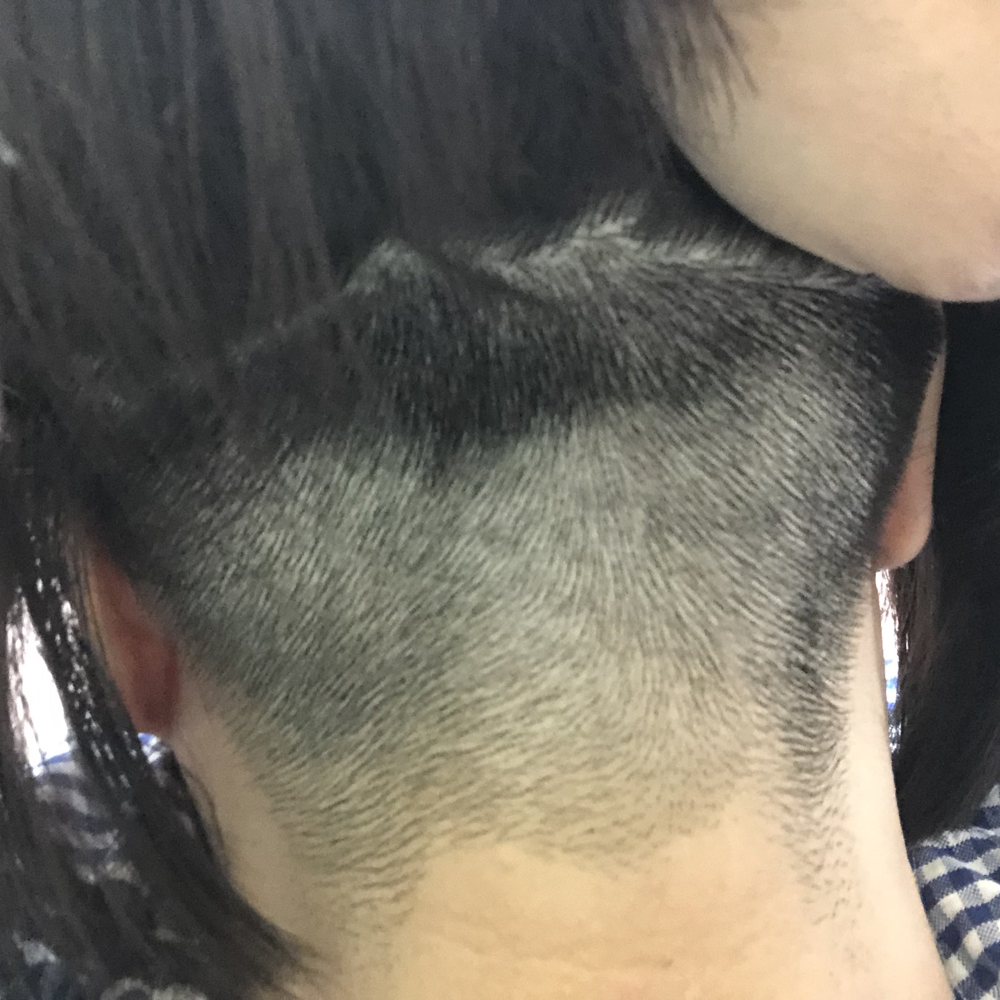 もも 後ろはこんな感じで3mmバリカン サイドはハサミで少し長め 髪の毛下ろすと普通のボブ 写真で見たら刈りムラがある 美容院ではこれが限界なのかな 刈り上げ女子 3mmバリカン 次は1mmいけるかも