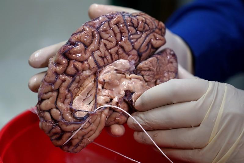 ReutersScience's tweet photo. Scientists hunt down genes behind humankind's big brain https://t.co/PpbTQ6l2JF https://t.co/V7fpaOQWqO