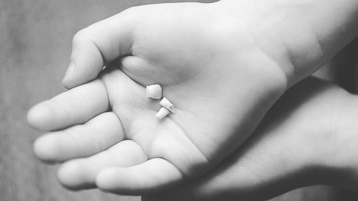 brushlink's tweet image. When we aren’t using Brushlink, this is what is happening to our children’s teeth!!!
#teeth #toothdecay #drinks #sugar #sweets #dentistry #dentist #children #parents #hygienist #junkfood #health #wellness #toothpaste #toothbrush #brushlink #data #analytics #smile #shine