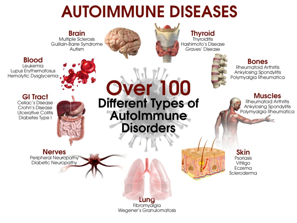 Immunology_g's tweet image. #autoimmune #autoimmunediseases #AutoimmuneResearch
#FutureImmunomodulationStrategies
#CurrentEvidence #FuturePerspectives_Autoimmunity
#RadioImmunotherapy #CancervaccinesDevelopment
#Immunotherapy: powerful-but-Blunt Weapons
…ogycongress.immunologyconferences.org/events-list/au…