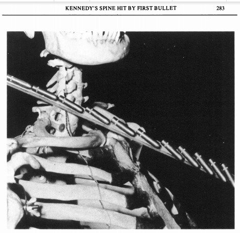 11221963's tweet photo. Scientist Neutralizes JFK’S ‘Back and to the Left’ — or Does He?https://t.co/a7REFW12Fk #backandtotheleft #jfk #dealey #lho #conspiracy https://t.co/nHs8zsDGgv