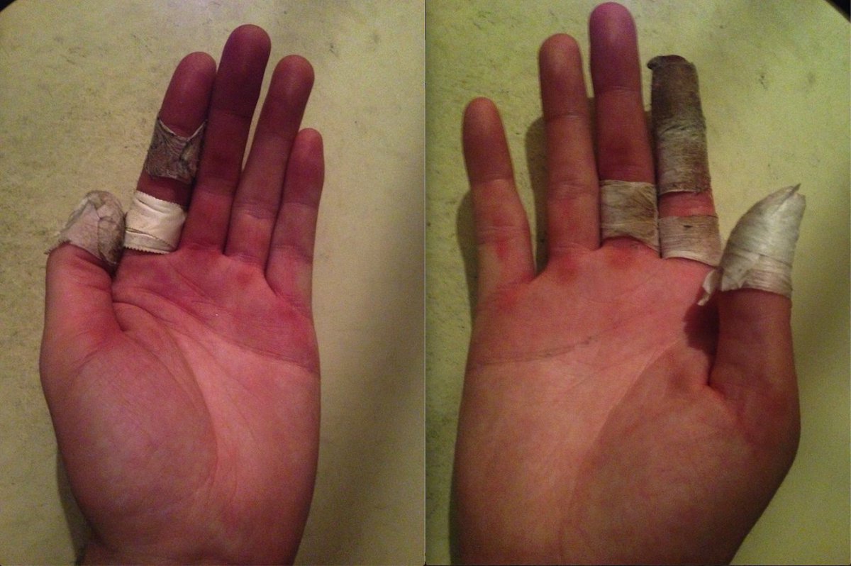 Matt’s hands after drumming on the With Riddles EP. Did you know he played drums on the EP? Did you know he has dainty hands?