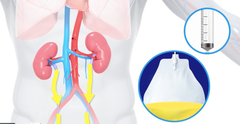 RenalGuard Solutions tweet media