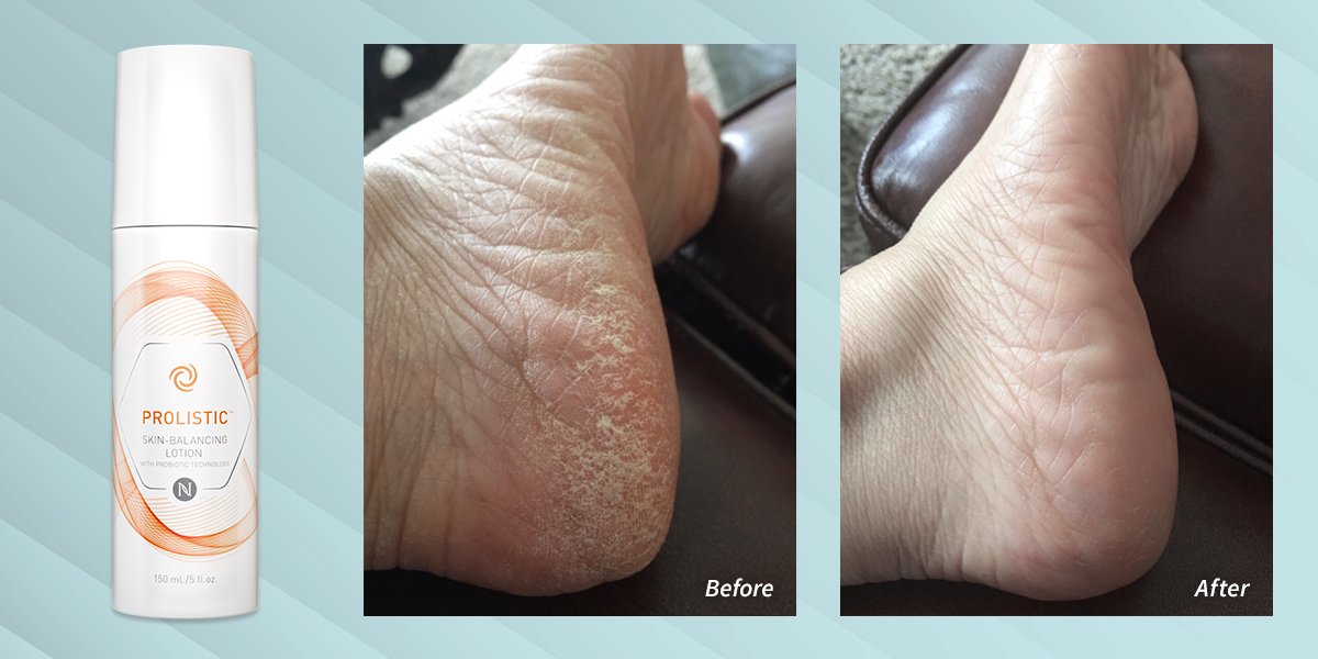 neora prolistic lotion reviews