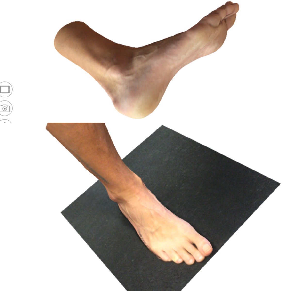 Achieving Fantastic 3D scans with pocket sized devIces! Seconds to take scan and only minutes before it is being 3D printed in our new #stateoftheart dept. #footwear #afo #orthotics #anatomy #leadingbyexample #orthotix #dacey #pdr #welshgovernment #nhs