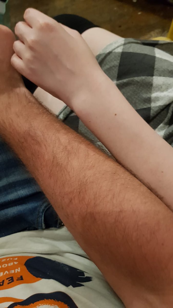 Holgeristen's tweet photo. Die Hautfarbe eurer Päpstin @Rica_Snow und eurem Grafen @Marcodore_ 
Man erkennt fast keinen Unterschied. 😂 https://t.co/aH3MalIbrl