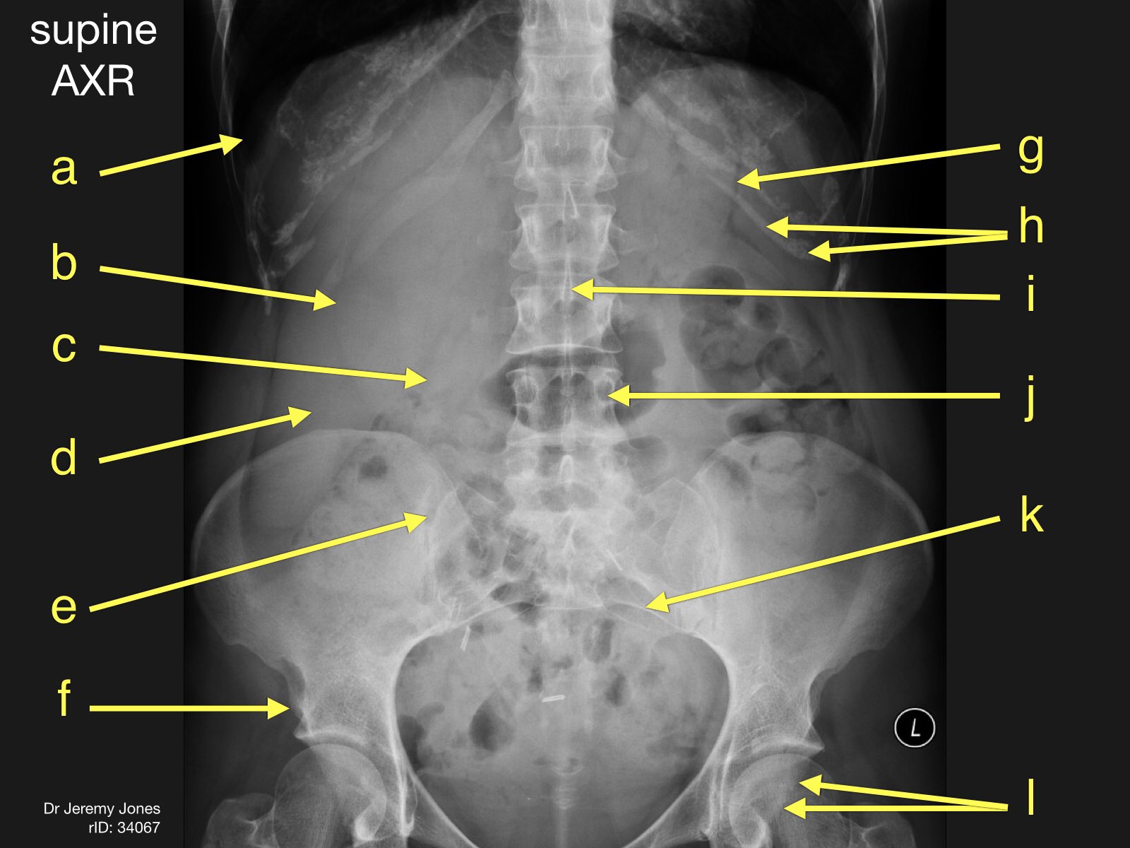 on Twitter "Our 2018 Medical Imaging Anatomy Course is
