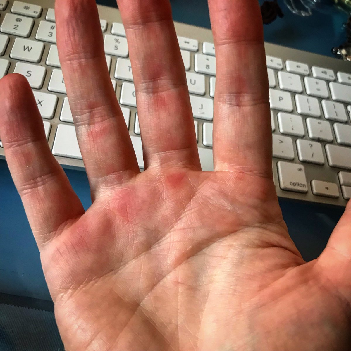 how to make your hands stronger