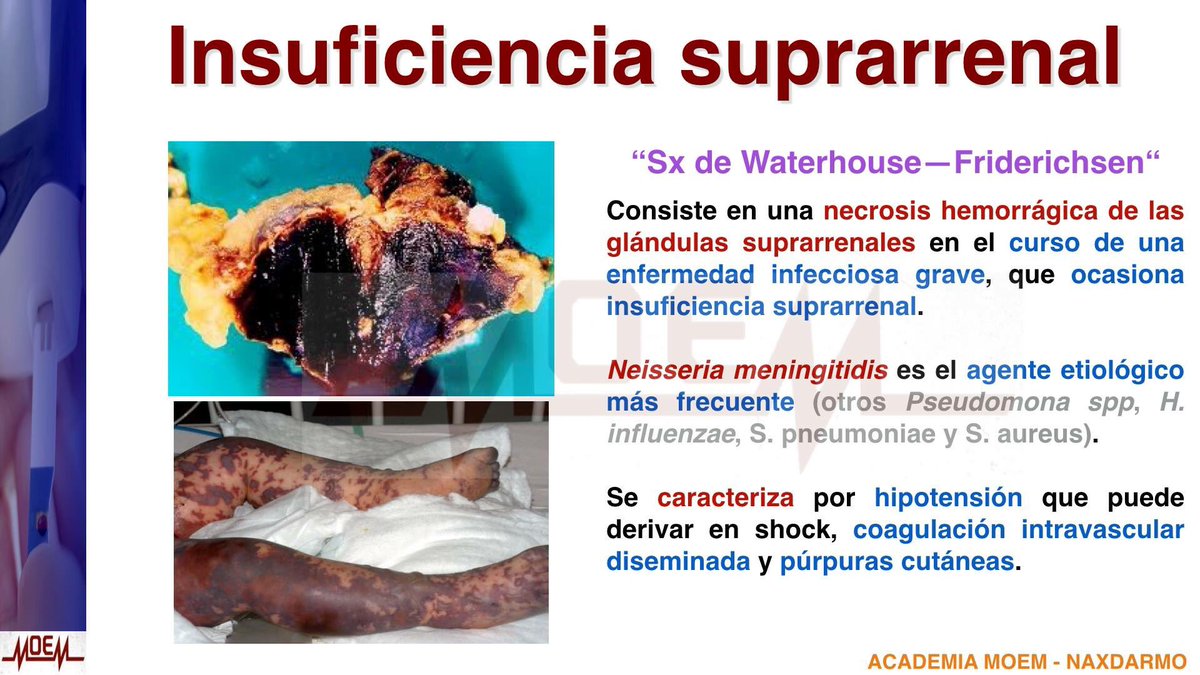 academia_moem's tweet photo. #AcademiaMOEM #MOEMCARDS #MCendocrino 
Un RT nos ayudaría a crecer como comunidad https://t.co/fhX9wMtdkX