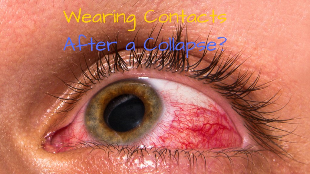 ReadyLifestyle's tweet photo. "Antibiotics can be used to treat the infection and are normally prescribed by today’s doctors." https://t.co/koSSpx8rEL #Prepping #SHTF #PostCollapseSHTF https://t.co/haoTaQqi2I