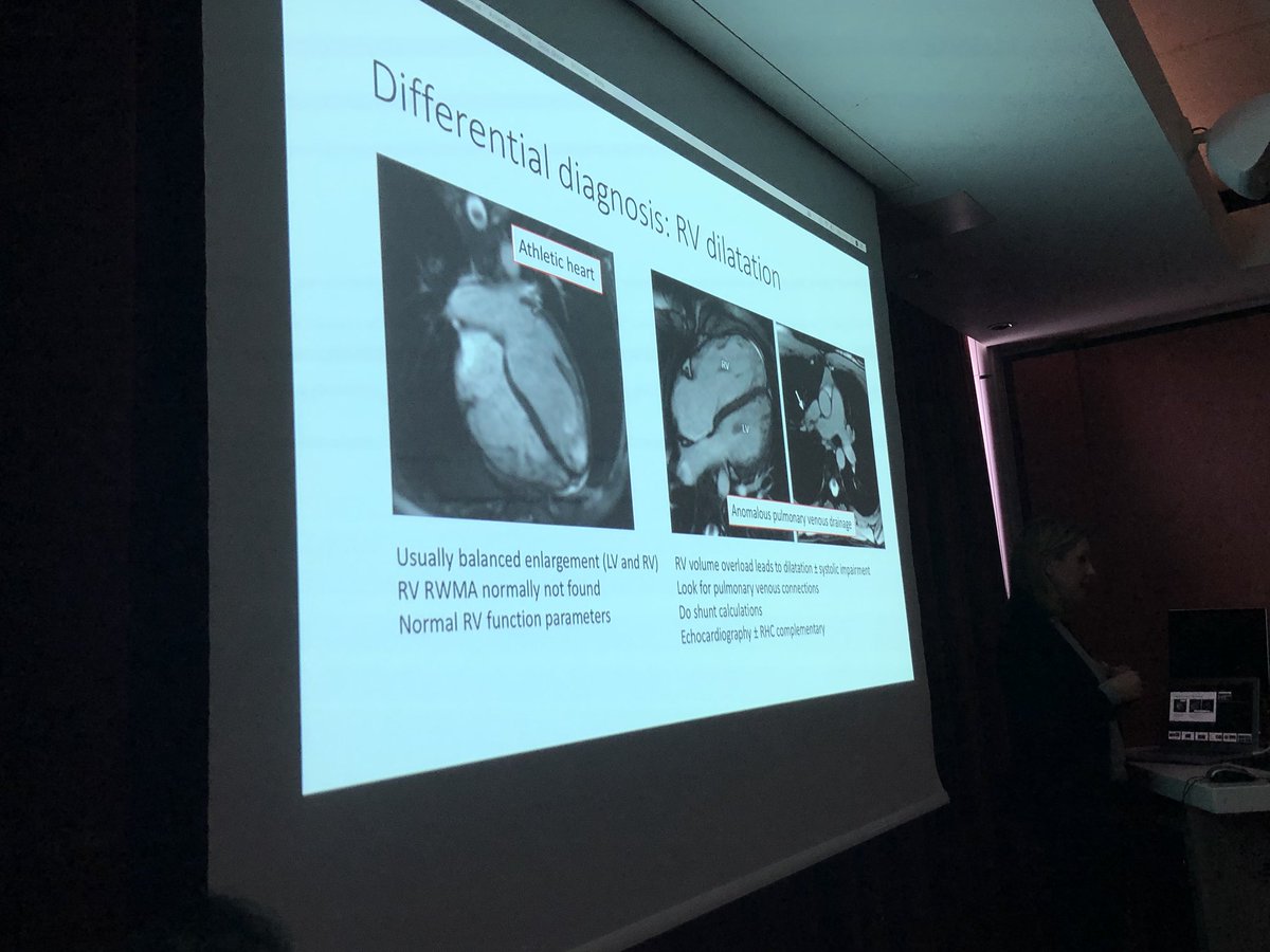 MichaelPapadak2's tweet photo. Utility of ECHO and CMR on the diagnosis and risk-stratification of #ARVC / #ACM Athletic adaptation, mimics, left-dominant disease. Great talks @rach_bastiaenen and @SPapatheodorou @StGeorgesUni @StGeorgesTrust #imagingcourse https://t.co/BMLHv0lGCa