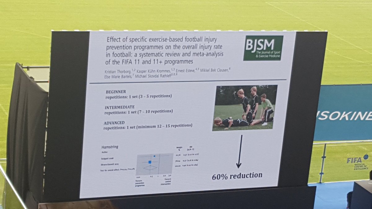 Nim_Perera's tweet photo. Nordic hamstring exercise reduce #hamstring injuries by 72% in amature #soccer playershttps://www.ncbi.nlm.nih.gov/m/pubmed/25794868/ 

60% reduction in #football players @KThorborg https://t.co/8ynFTr2hx0
@BJSM_BMJ

#FFMED
#footballmedicine https://t.co/zorKMrPyKD