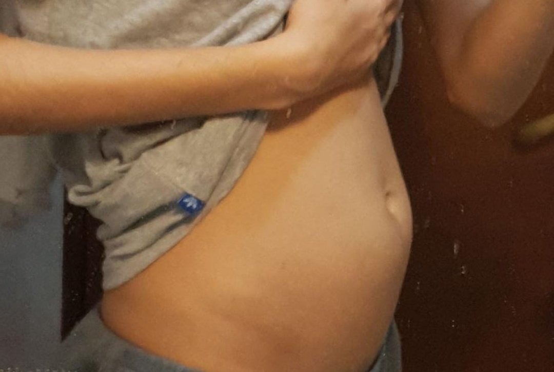 mariacg____'s tweet photo. Mi barriga sin la regla vs mi barriga con la regla https://t.co/2aNttu0ZfK