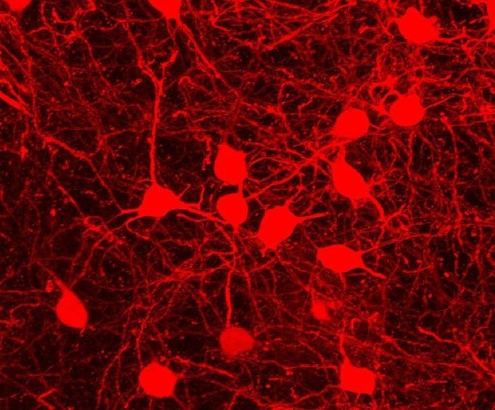 ArBreatheWithUs's tweet photo. Science (in)verse: Ben Zarov ii https://t.co/crf0lbK5kA 
#science #poetry #SciArt  #ArMagazine  #neuroscience https://t.co/WESPscNkni
