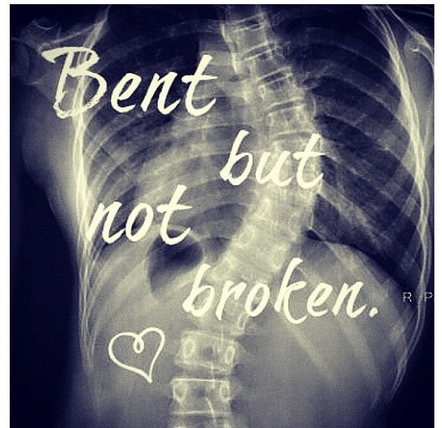 Bent, but not Broken