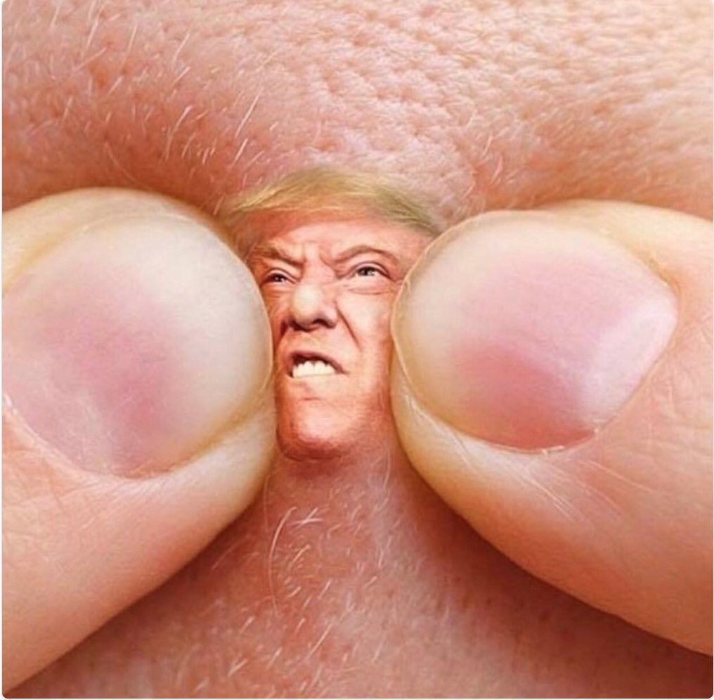 WilliamFPeters2's tweet photo. @Rich705 @cyndi_mcdowell @Kokomothegreat @funder @RealMuckmaker @Nicoxw1 @SoulStealer25 @Pajjr2016 @DearAuntCrabby @ChrisLutolf @Bray_NYC @real_farmacist @heretical_1 @ITMFA_NOW @ScottFrazier19 @ProudResister @GOVTWINE @suzysmiles__2 @jwheels74 @PenceConscience @CherylRutledg17 @garypgarrett @a56wildkat @carlyinNJ @Lonestarindie @spiritmoon7 @Frimmmy @ReplyWithAMeme @TimothyKenison @simonsezimpeach @SassyGash @jinngaa @Steve03343829 @britin17k @carolynbadkins @KristinaMoline @7ThingsOracle @Zori_C @srmduke87 @Stitchie26 @gabe0827 @Orionarmstar @ndirish1973 @itslaura4sure @BernieMamorbor @sclaresjt @clydetucker328 @2018_Liberal @aprilbaxter @BrianCyphers1 Something like...🤔 Oh I wish it was this easy to #Pop45 or...🤔 Kim puts the squeeze on #TraitorTrump’s negotiations... or as Lector would say...maybe... Holy Shit Balls this zit looks trump... or..🤔 last one.. I got u now puss brains...hold still...splat..too much?
#VoteBlue https://t.co/MT4sabrDUD