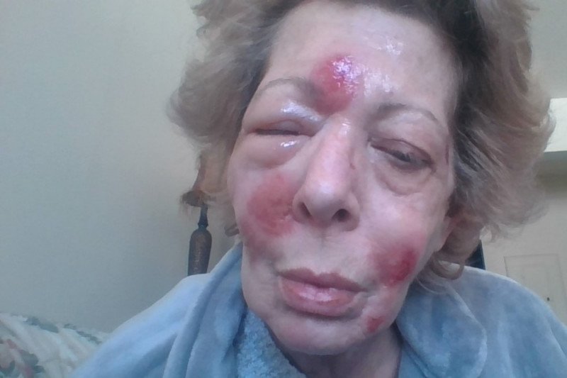 ididitucan's tweet photo. โฅ๏ธ RETWEET SHARE SUPPORT! Disabled 60 Yr. Old Woman Needs Help #HelpLinda #Gofundme #CrowdFundingExposure #zumafunder PLEASE SUPPORT ~> https://t.co/MkjwMFNxPl https://t.co/1IyI4NlRYi