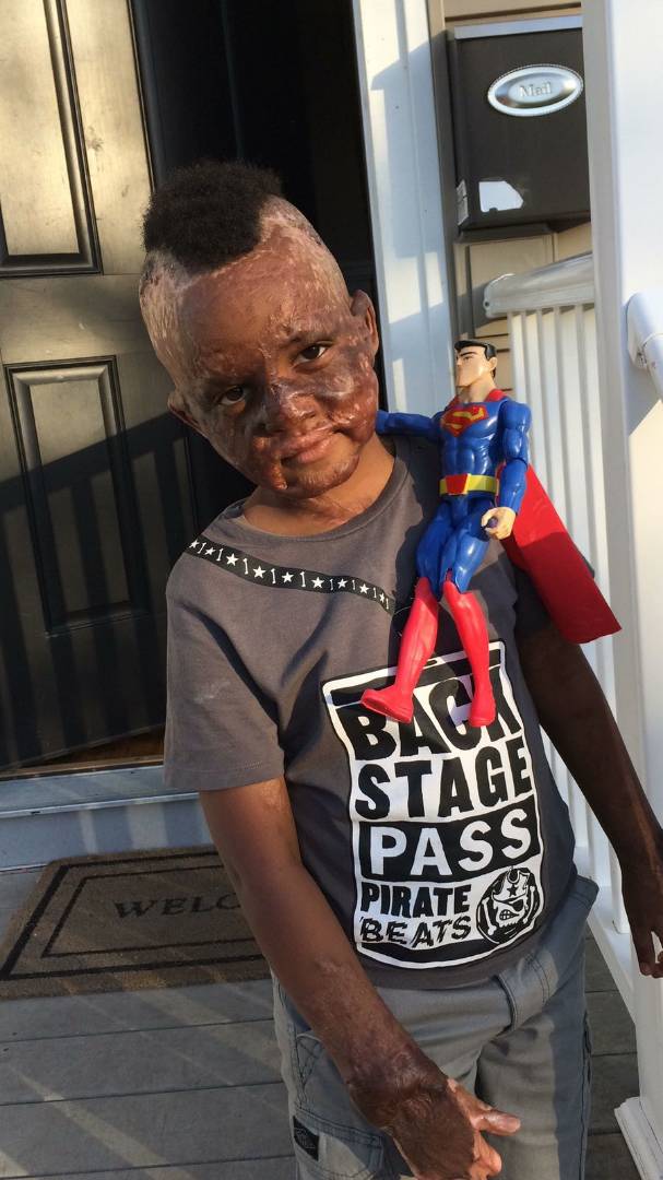 Akeza Burundi A Twitter Aidez Nous A Souhaiter Un Joyeux Anniversaire Au Petit Jonathan Un Vrai Battant Ce Petit En Passant Il Est Toujours Aux Usa Pour Soins Specialises On Ne Peut Lui