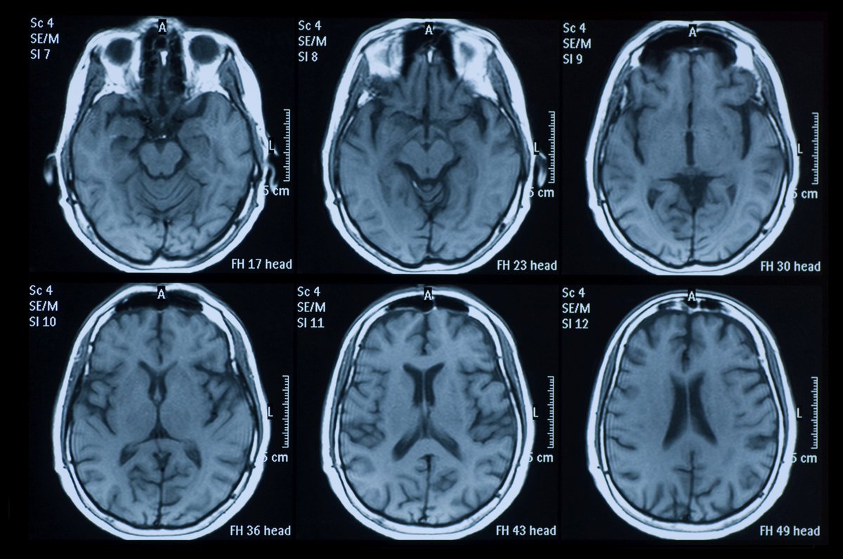 Pernah tengok imbasan MRI? Hah lebih kurang macam tu lah. Perasan tak bentuknya yang berubah-ubah ikut keratan?