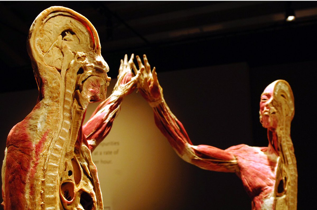 Retlouping's tweet image. We have a tendency to break things up into understandable chunks, create simple models &amp;amp; base our decisions about treatment on this disection &amp;amp; simplicity. We forget that the bits are part of a complex whole &amp;amp; our models do not really reflect the complexity.
#nervoussystem.