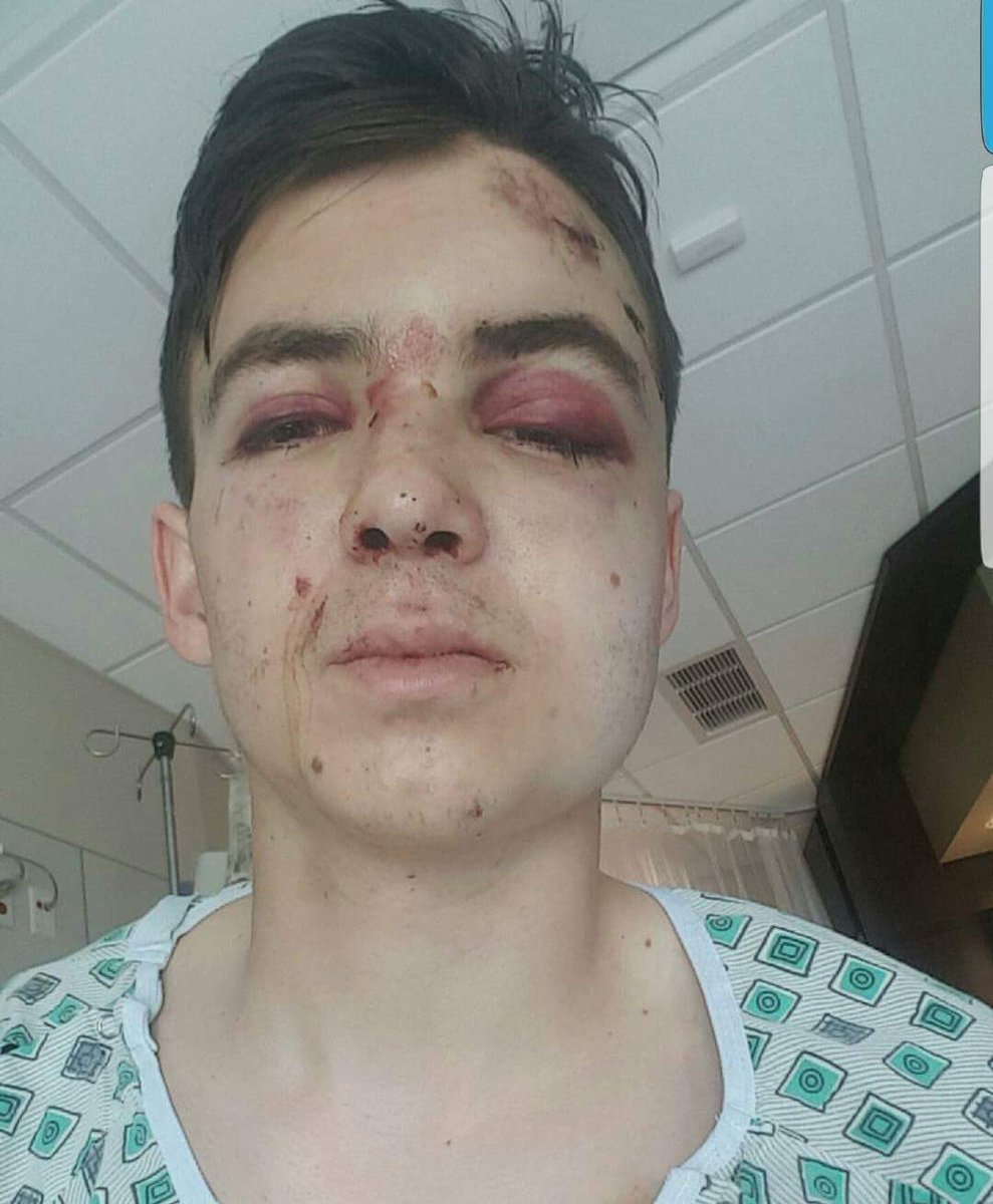 HylerTirsch's tweet photo. Wow. Today marks 2 years since the day paramedics thought I was dead. It’s pretty crazy how life can change completely in 2 short years, but I’m glad to be here. 

Keep an eye out for motorcycles everyone. It only takes a second to change or end someone’s life. https://t.co/tTAHSiWGNM