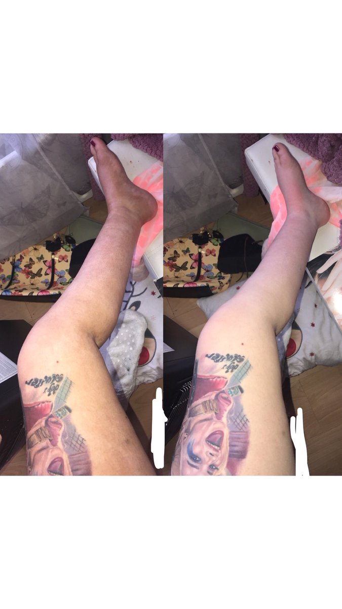 frankiel9328's tweet photo. 1st time using @cocoabrowntan Fresh Start &amp; I’m amazed no more patchy tan! I had a CB spray tan a week ago &amp; I’m paler! My underwear tan line faded ALOT! the tan gathered on my ankles is now GONE! You get a tingling feeling but it’s nothing severe its a game changer #CBFreshStart https://t.co/4jifhcZ5sQ