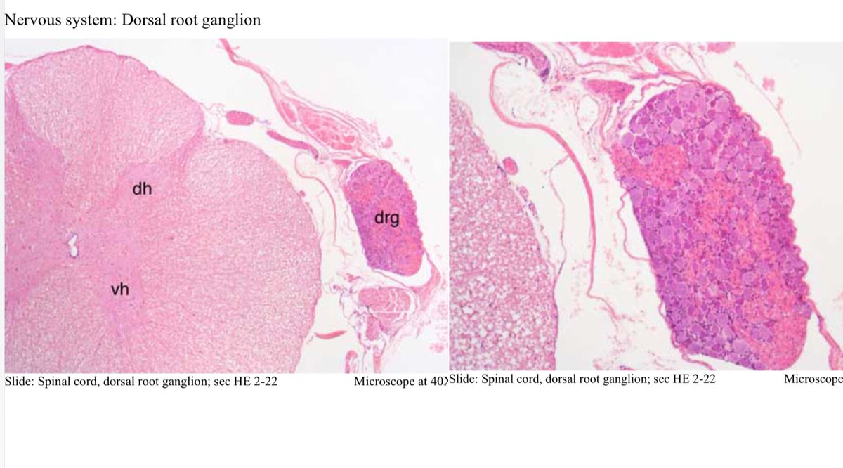 SOLUTION: Histology spinal cord image mbbs notes H and E image of spinal  cord describing about all his featured and labelled diagram. - Studypool, image size:1200x666